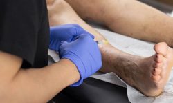 Varicose and Visible Veins