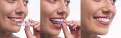 orthodontist specialist