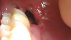 Childrens Dentist That Accept Medicaid