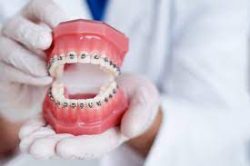 Best Rated Orthodontist Near Me
