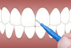 Best Orthodontist Office In North Miami