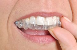 Invisalign Orthodontist Near Miami, Florida