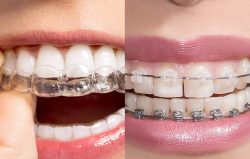 miami fl orthodontists