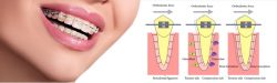 Orthodontists In North Miami Beach, Fl