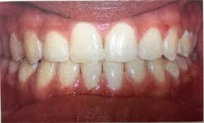 Orthodontist Near North Miami FL
