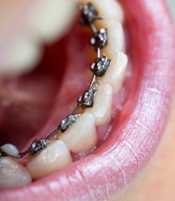 Orthodontist Open On Saturday