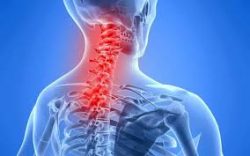 NECK PAIN SYMPTOMS