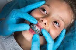 FINDING THE BEST KIDS ORTHODONTIST NEAR ME