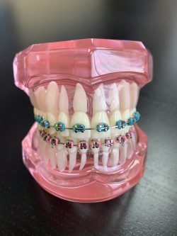 WHAT SHOULD YOU LOOK FOR IN AN ORTHODONTIST OPEN ON SATURDAY?
