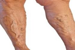 Check if the clinic employs qualified vein doctors