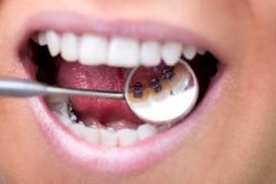 Multi-Specialty Dental Clinic In Gurugram