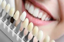Your Smile is Your Best Fashion Accessory