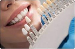 WHAT CAN YOU DO TO TAKE CARE OF PORCELAIN CROWNS?