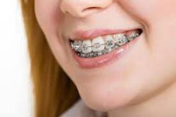 FINDING THE CORRECT ORTHODONTIST NEAR ME