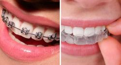 GETTING TREATMENT FROM ORTHODONTIST NEAR ME