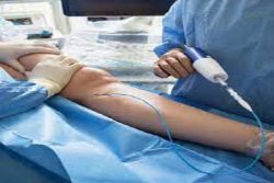 Practices minimally invasive vein treatment