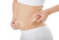 Best Liposuction in Guwahati | Sculpt India