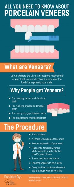 Ala Din DDS – Porcelain Veneers Expert in Palo Alto, CA