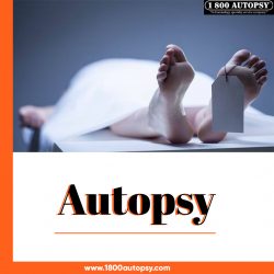 Autopsy