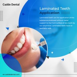 Best Quality Laminated Teeth Application – Cadde Dental