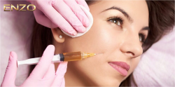 Buy Dermal Fillers Online USA