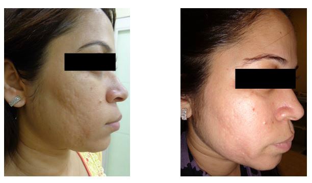 Best Cosmetic Clinic in Guwahati | Sculpt India