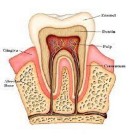 Emergency Root Canal