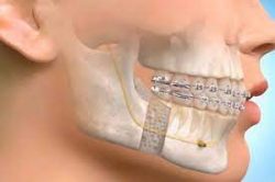 Oral And Maxillofacial Surgeon | Gregory Casey