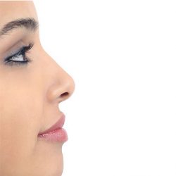 Best Rhinoplasty surgery in Guwahati | Sculpt India