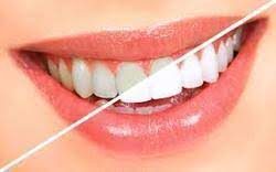 One of The Best Invisalign Dentist In Houston