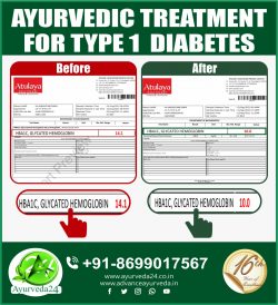 Another Success Story of type 1 Diabetes. Many More to Come