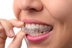 Invisalign Dentist