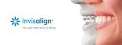 Invisalign in Houston – Exquisite Smiles