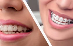 Orthodontist For Adults Near Me