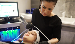 Microdermabrasion Treatment