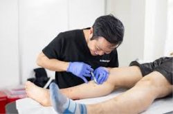 Vein Treatment Clinic