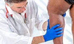 Varicose veins treatment NYC