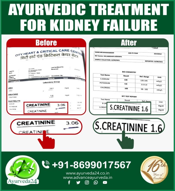 Another Success Story of ???? Ayurvedic treatment for kidney failure. Many More to Come