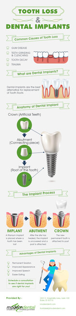 Get Top-Quality Dental Implants in Boise, ID from Modern Dental