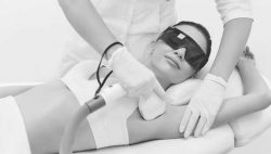 Full Body Laser Hair Removal