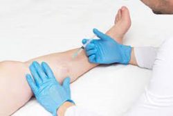 Harvard Trained Vein Doctor | Vein Treatment Center