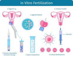 Best IVF Centre in Jaipur 2021 | Aurawomen