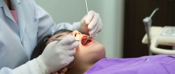 Cavity Treatment