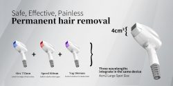 Permanent Hair Removal