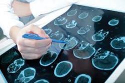 Expert Neuropsychologist For Health