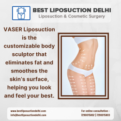 How is Liposuction Cosmetic Procedure Perfect for Thighs, Hips, and Buttocks?