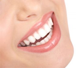 Lumineers San Diego Dentist – The Gentle Dentistry