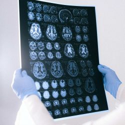 Dr. John DenBoer: Neurological Health