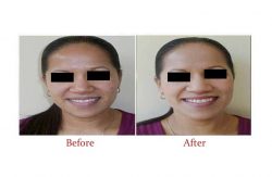 Best Cosmetic Surgeon in Delhi | Dr. Vivek Kumar