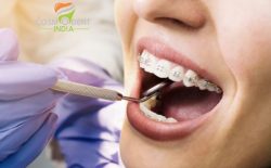 Cosmodent India | Dental Hospital in Delhi